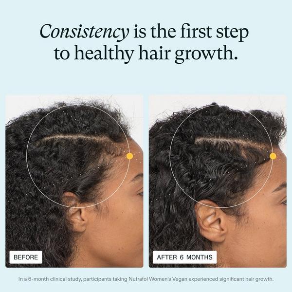 NUTRAFOL Women's Vegan 18-44 Clinically Tested Hair Growth Supplement #3