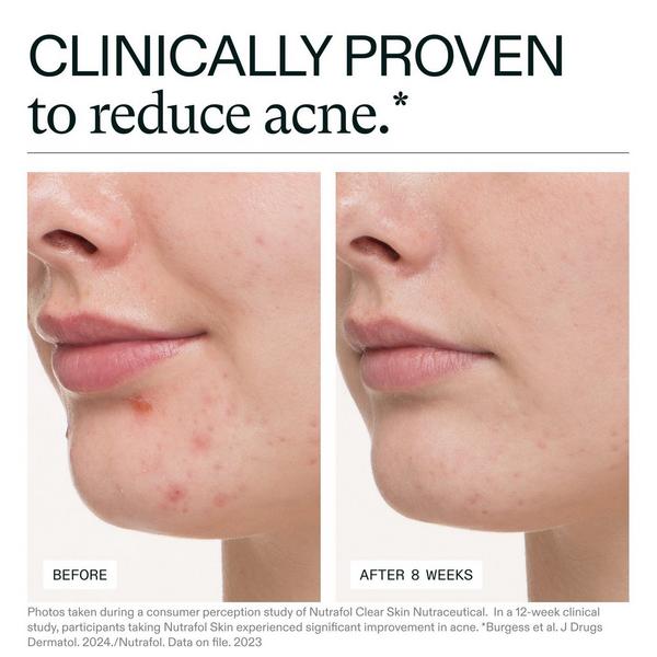 NUTRAFOL Clear Skin Clinically Proven Supplement for Acne + Breakouts #2