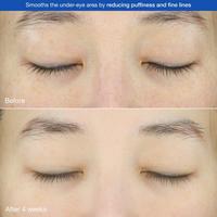 Chasin' Rabbits Bunny Line Smoother Eye Cream #6