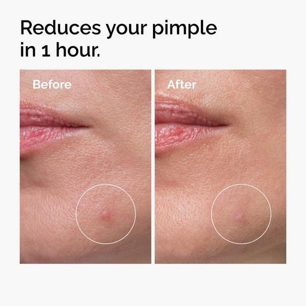 The Ordinary Sulfur 10% Powder-to-Cream Concentrate #4