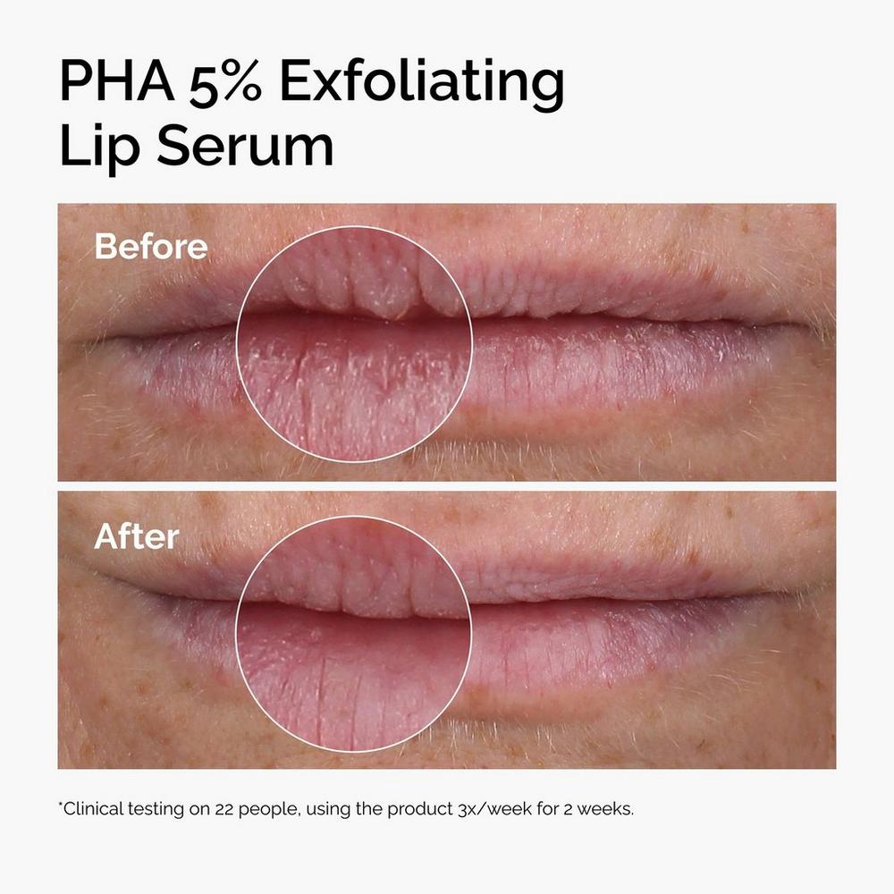 PHA 5% Exfoliating Lip Serum