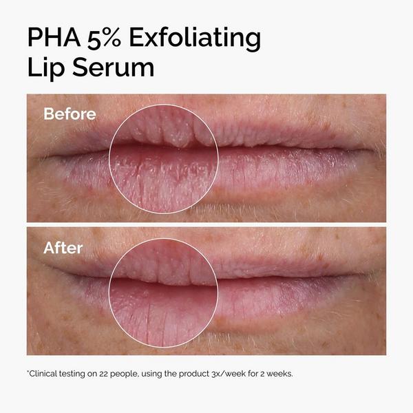 The Ordinary PHA 5% Exfoliating Lip Serum #3