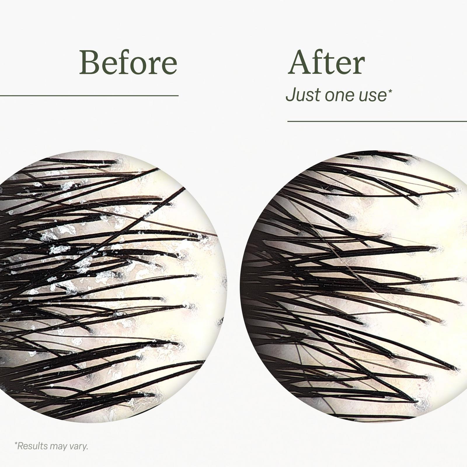 Scalp Reset Shampoo
