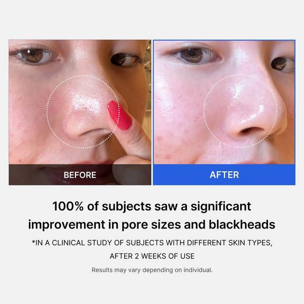 medicube Zero Pore Pad #6