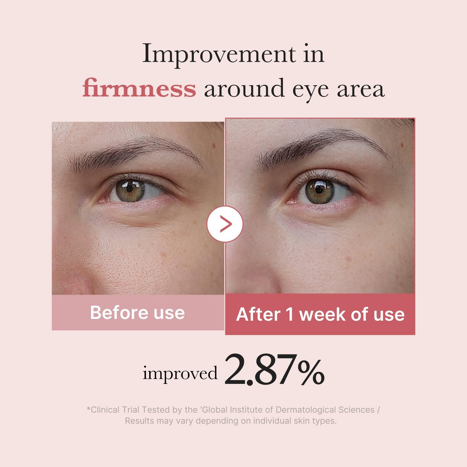 PDRN Pink Peptide Eye Serum