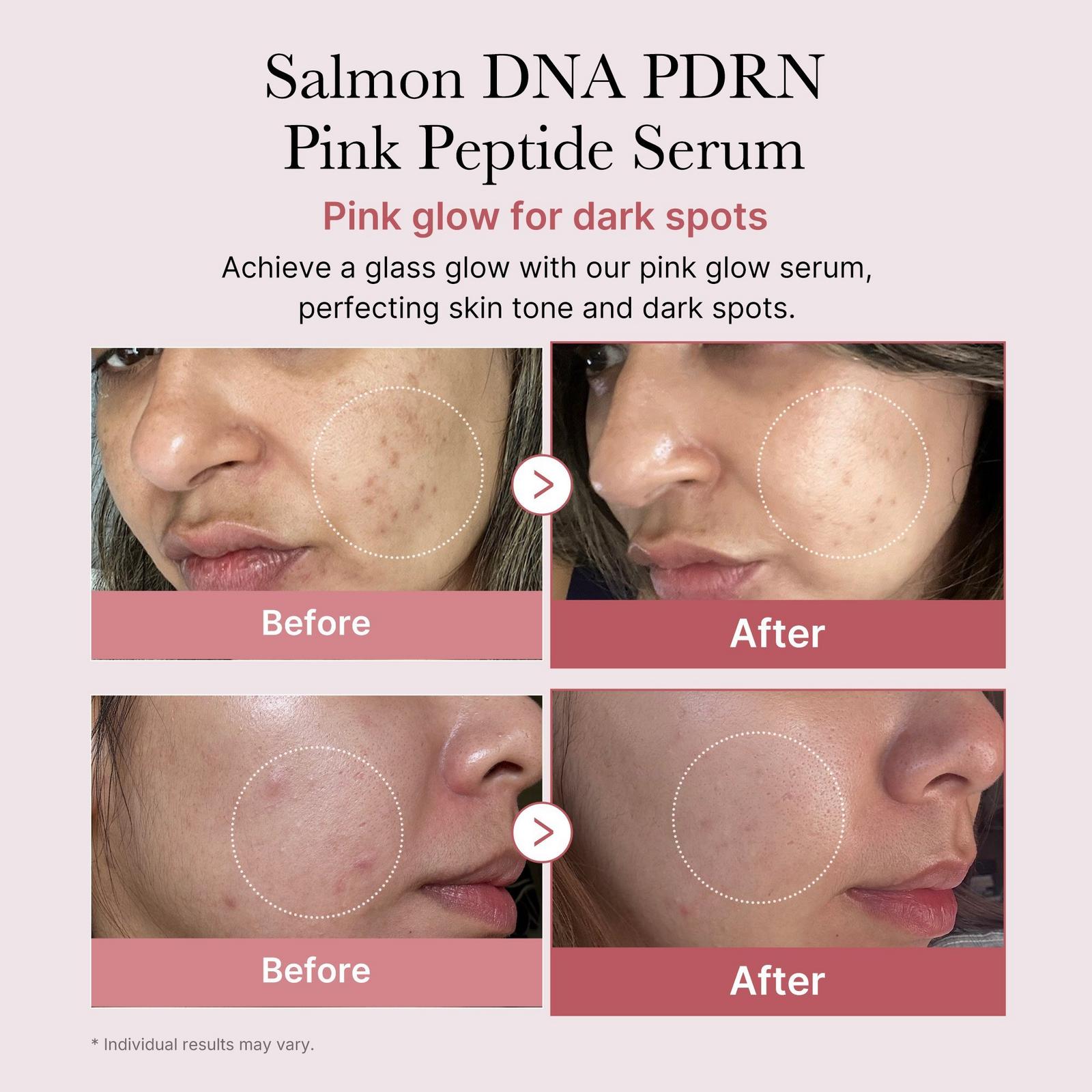 PDRN Pink Peptide Serum