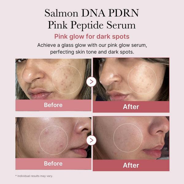 medicube PDRN Pink Peptide Serum #5