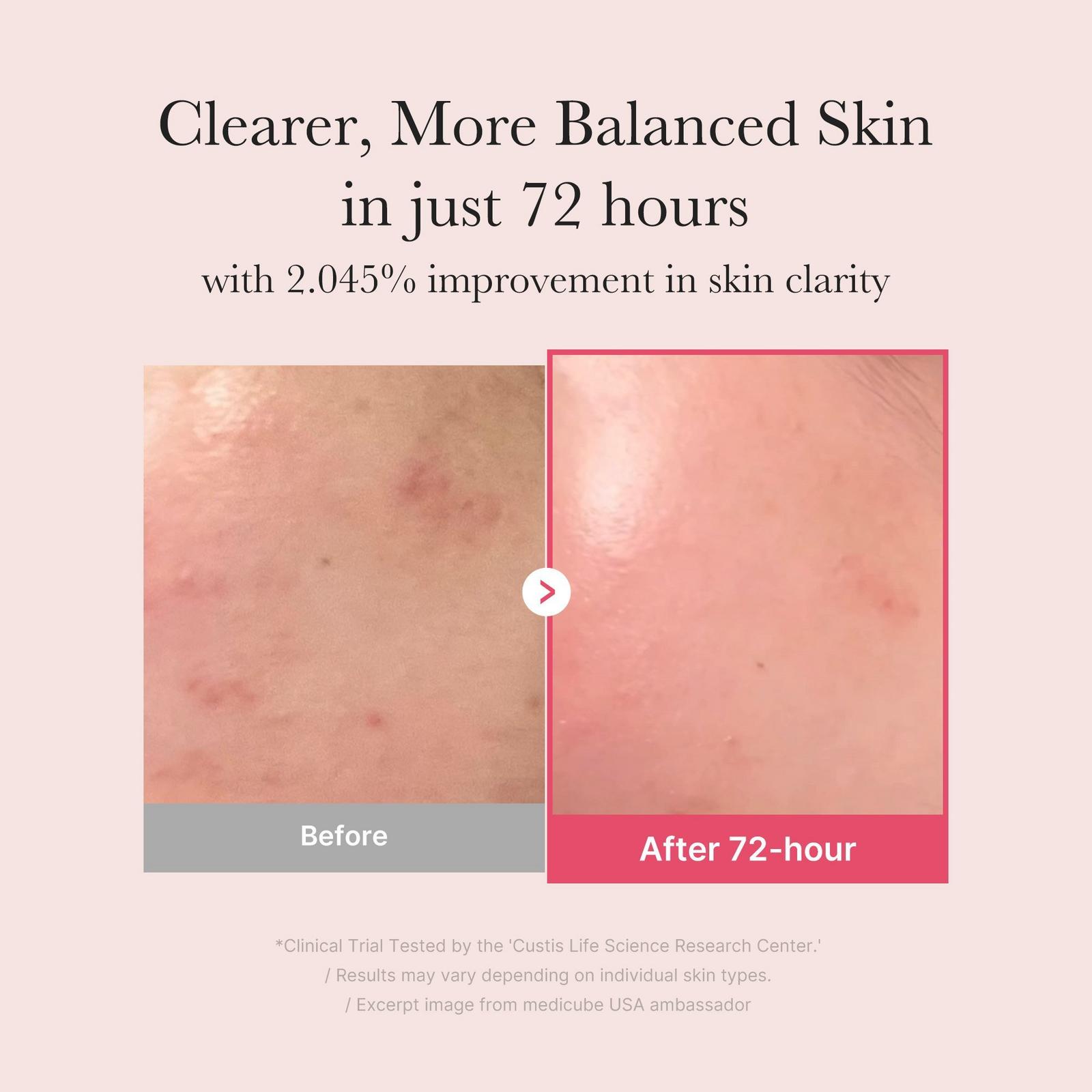 TXA Niacinamide 15% Serum