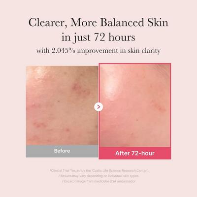 TXA Niacinamide 15% Serum