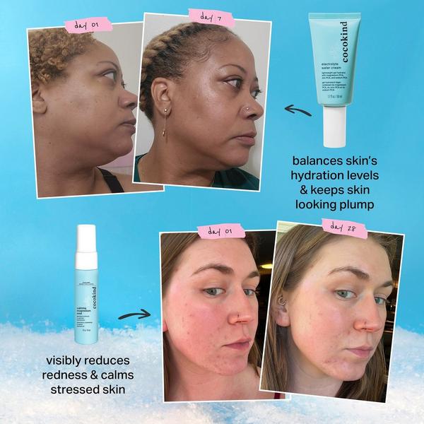 cocokind Hydrate & Chill Duo #4