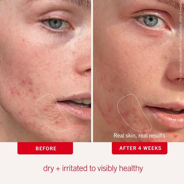 First Aid Beauty Ultra Repair Cream Warm Vanilla #4