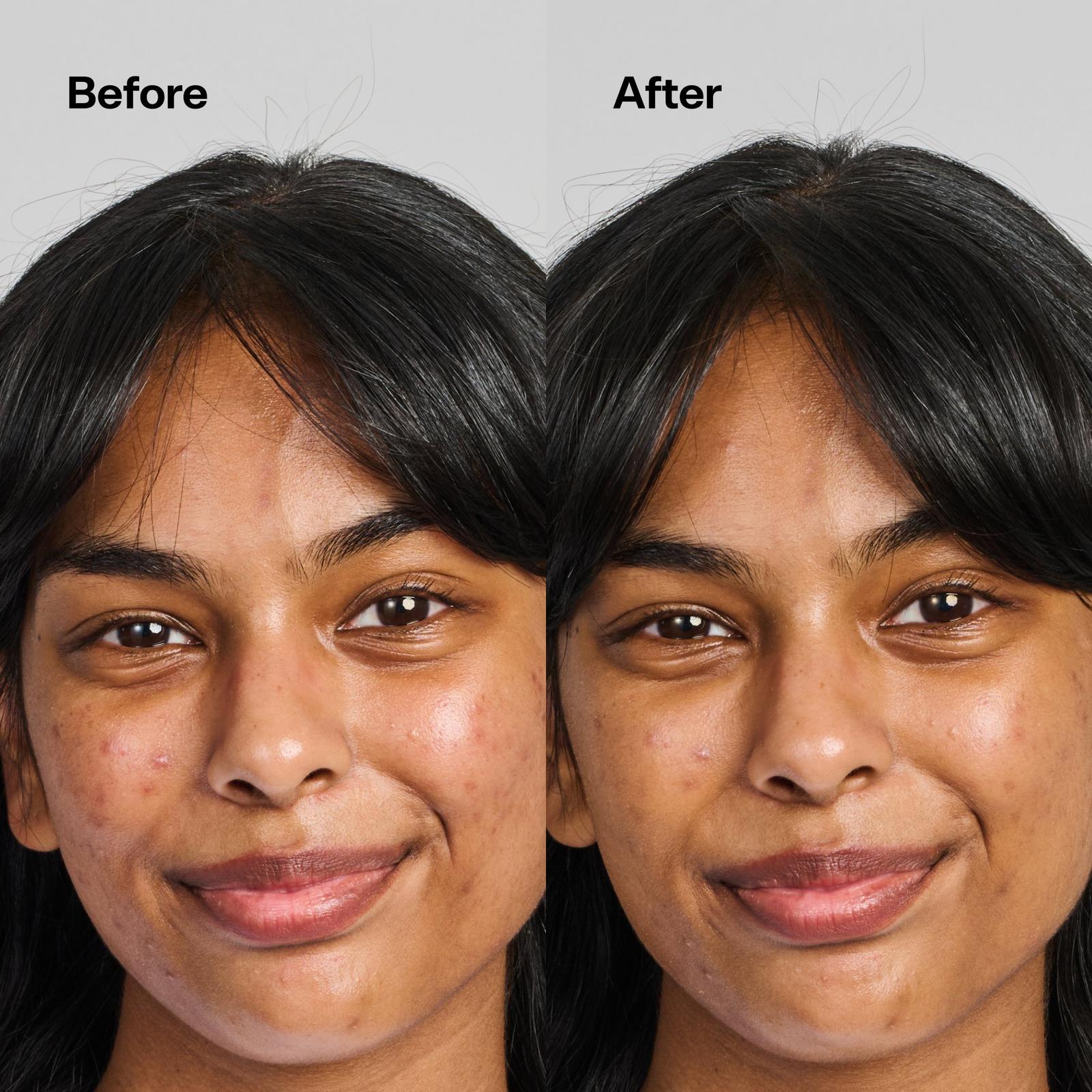 UNDER COVER Color Correcting Balm Dark Spot Fix