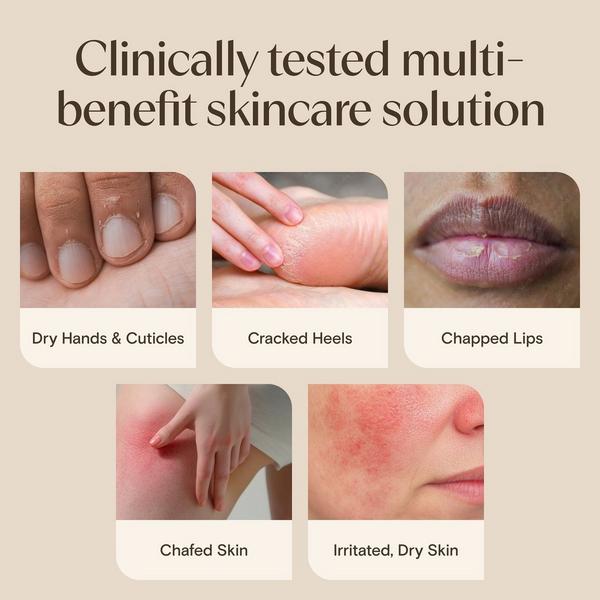 Aveeno Skin Relief Healing Ointment #4