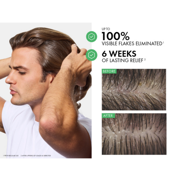 Vichy Dercos Selenium Sulfide Anti-Dandruff Shampoo #4