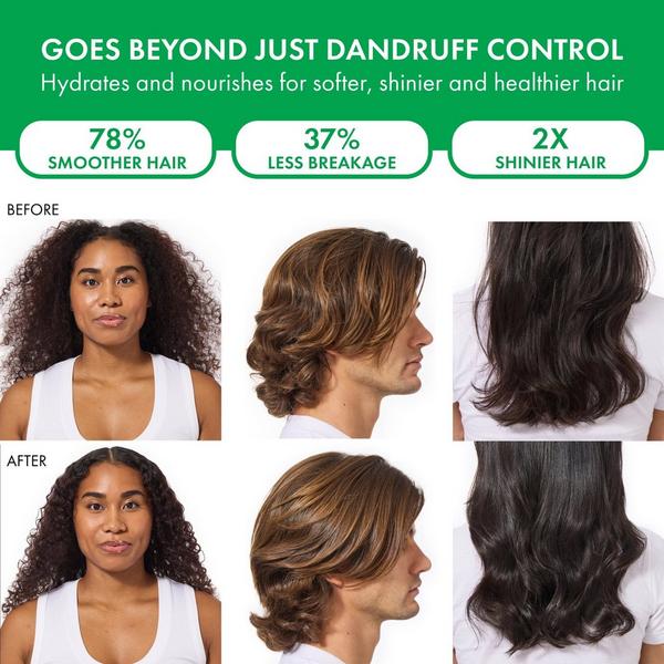 Vichy Dercos Selenium Sulfide Anti-Dandruff Shampoo #6