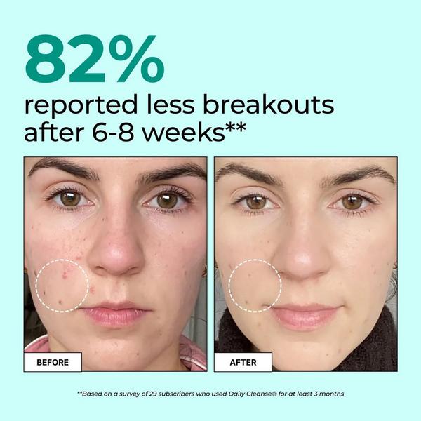 Hum Nutrition Daily Cleanse for Skin & Body Detox #3