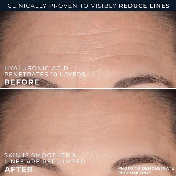 RoC Hydration+ Replumping Serum Stick #3