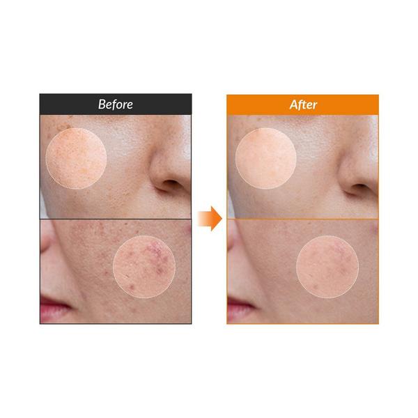Dr. Althea Vitamin C Boosting Serum #4