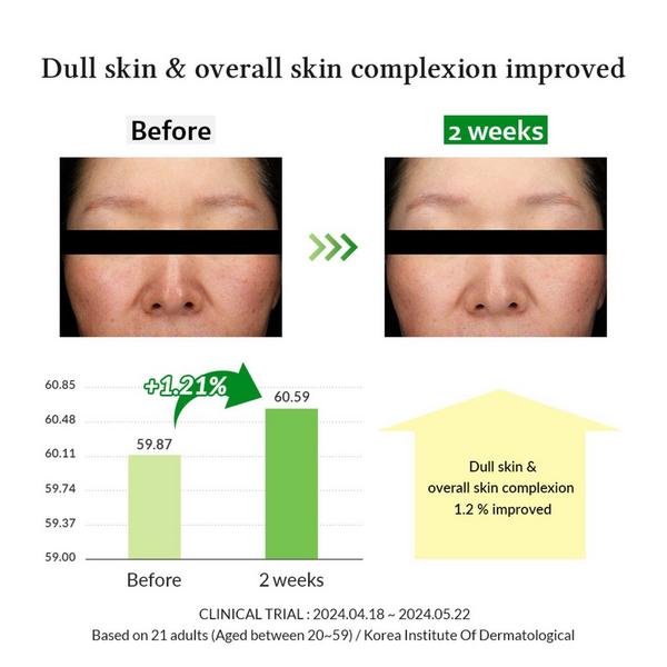 Dr. Althea Gentle Vitamin C Serum #4