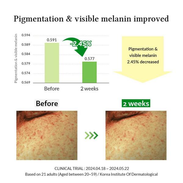 Dr. Althea Gentle Vitamin C Serum #5