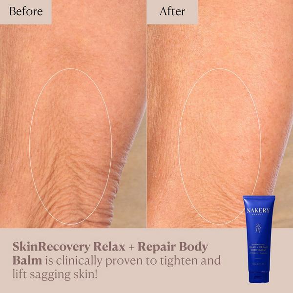 NAKERY BEAUTY SkinRecovery Relax + Repair Body Balm #5