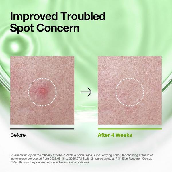 ANUA Azelaic Acid 3 Cica Skin Clarifying Toner #6