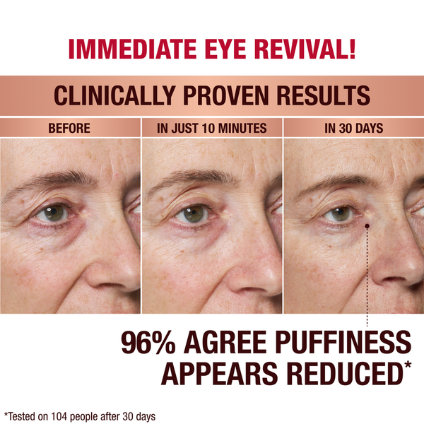 Charlotte Tilbury Immediate Eye Revival Patches #3