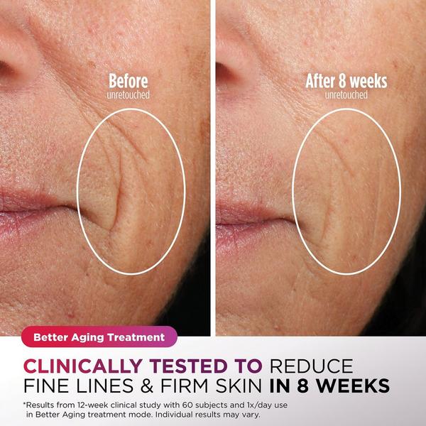 Shark Beauty CryoGlow Red Blue & Infrared iQLED Face Mask & Under Eye Cooling #8