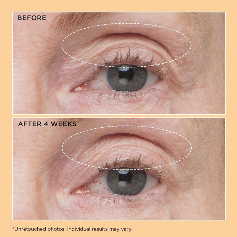 Perricone MD - Neuropeptide Eyelid Lift Serum | Ulta Beauty