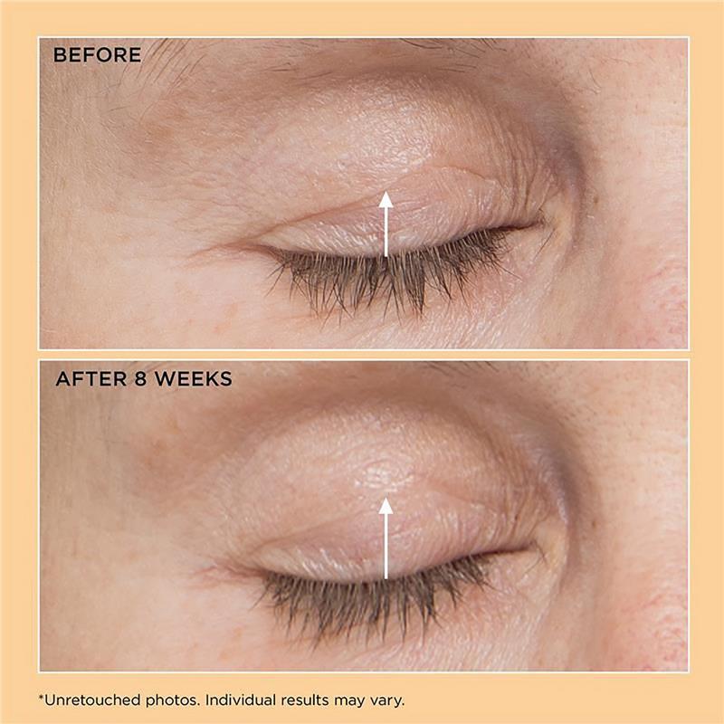 perricone md essential fx acyl-glutathione eyelid lift serum review Perricone MD Neuropeptide Eyelid Lift Serum