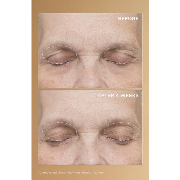 Perricone MD Neuropeptide Eyelid Lift Serum #6