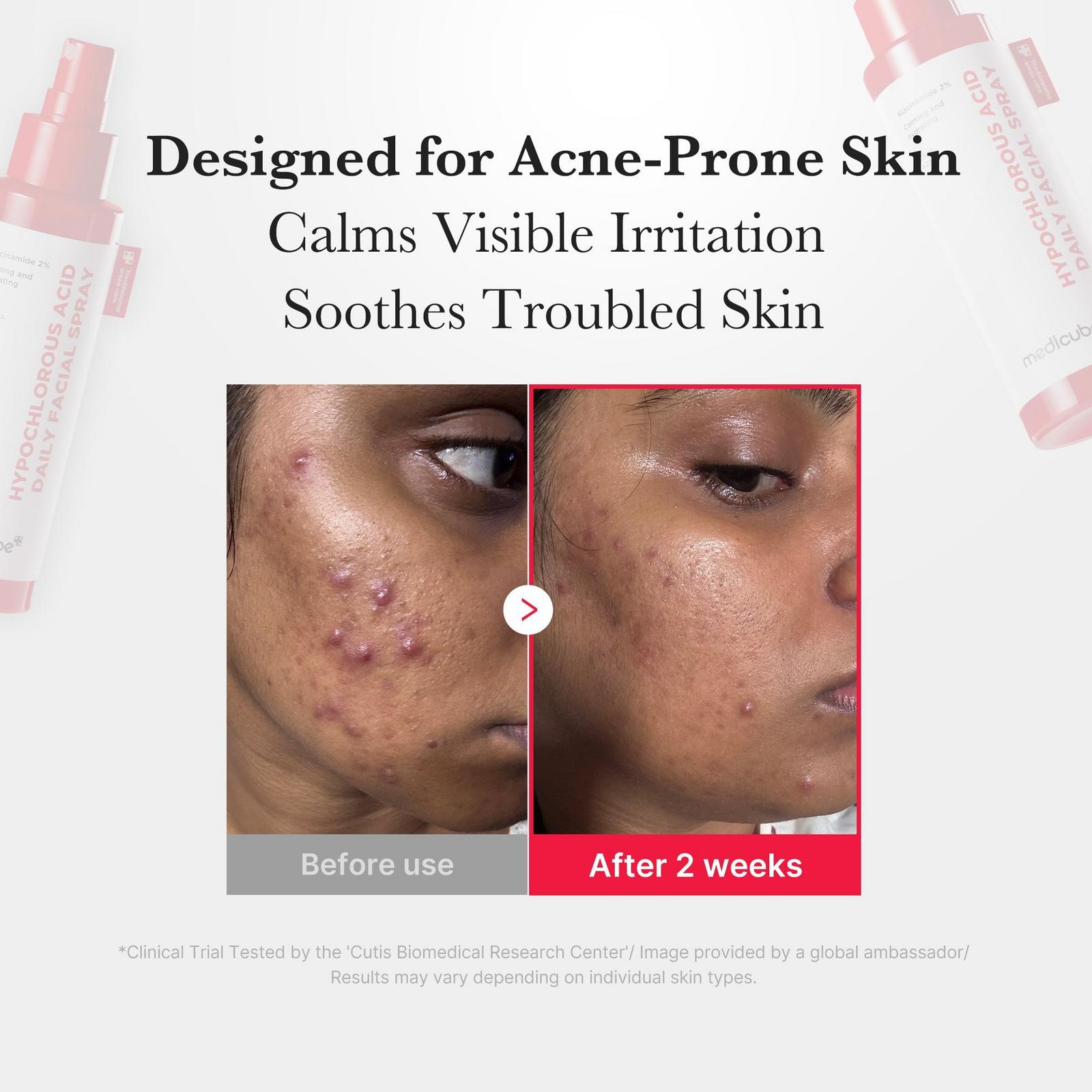 Hypochlorous Acid Daily Facial Mist