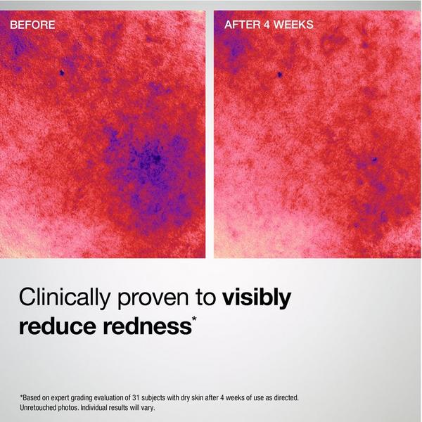 StriVectin Barrier Restore+ Soothing Ceramide Cream #6