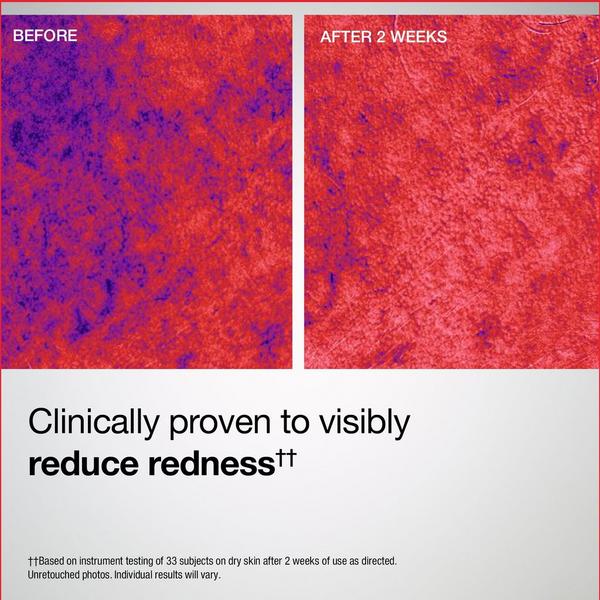 StriVectin Barrier Restore+ Soothing Milky Mist #8