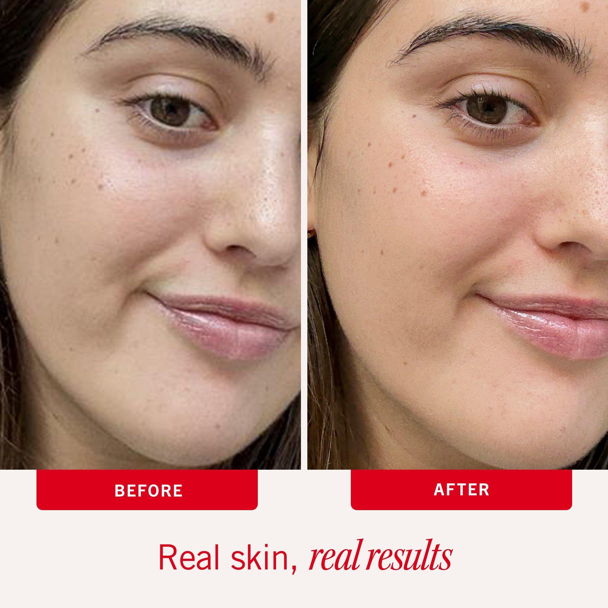 Лосьон для лица First Aid Beauty Ultra Repair — фото 4