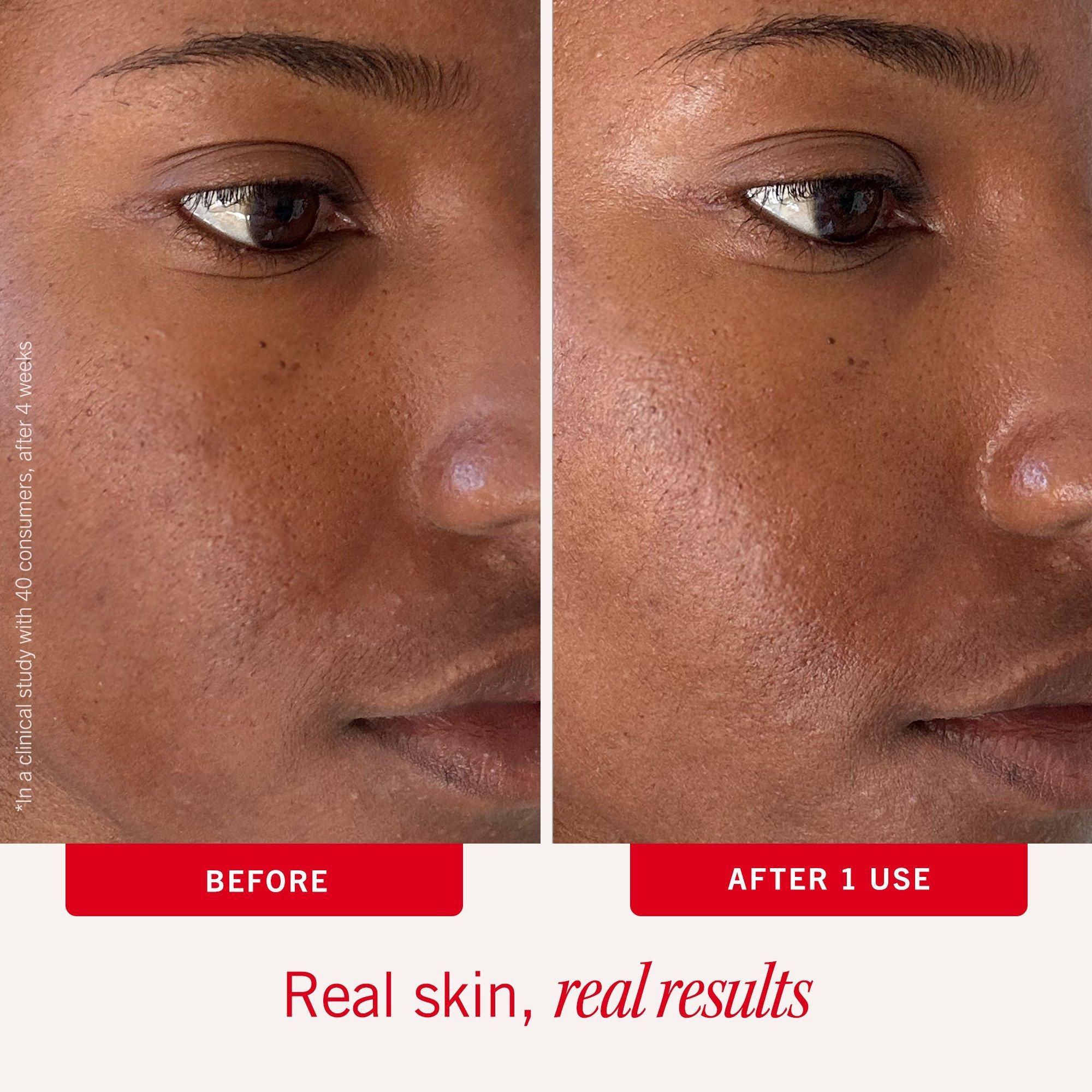 Увлажняющие подушечки с коллоидной овсянкой и керамидами First Aid Beauty Ultra Repair — фото 4