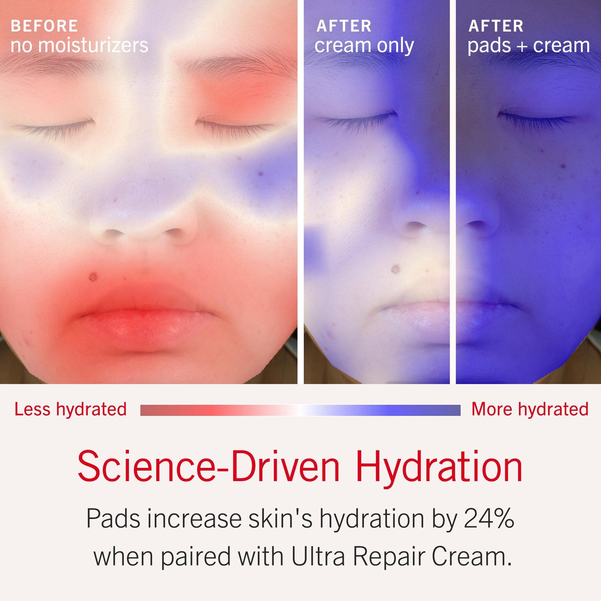 Увлажняющие подушечки с коллоидной овсянкой и керамидами First Aid Beauty Ultra Repair — фото 5