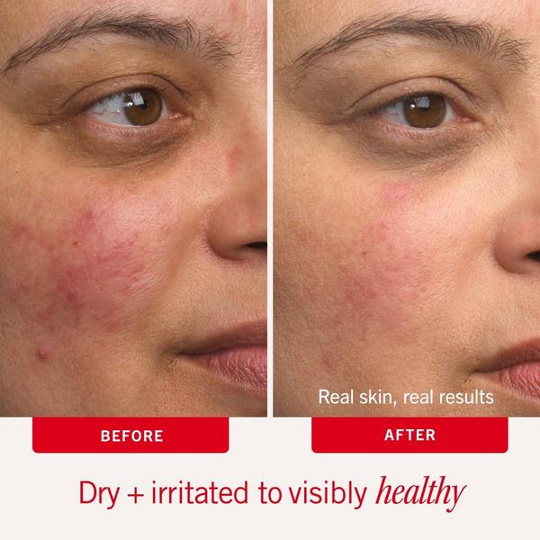 First Aid Beauty Ultra Repair Cream Intense Hydration Moisturizer #4