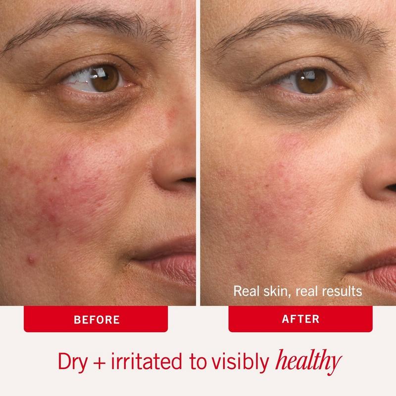 First Aid Beauty - 2.0 oz Ultra Repair Cream Intense Hydration