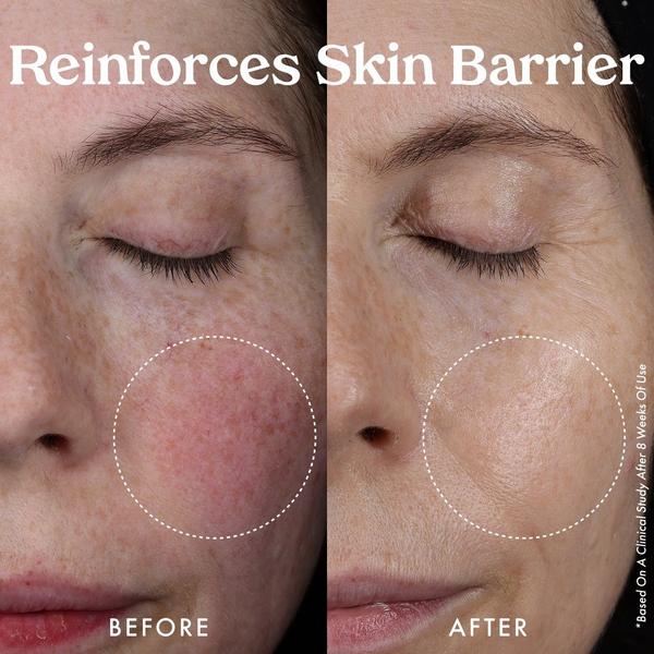 Kopari Beauty Nourishing Hydro-Lipid Barrier Serum #5