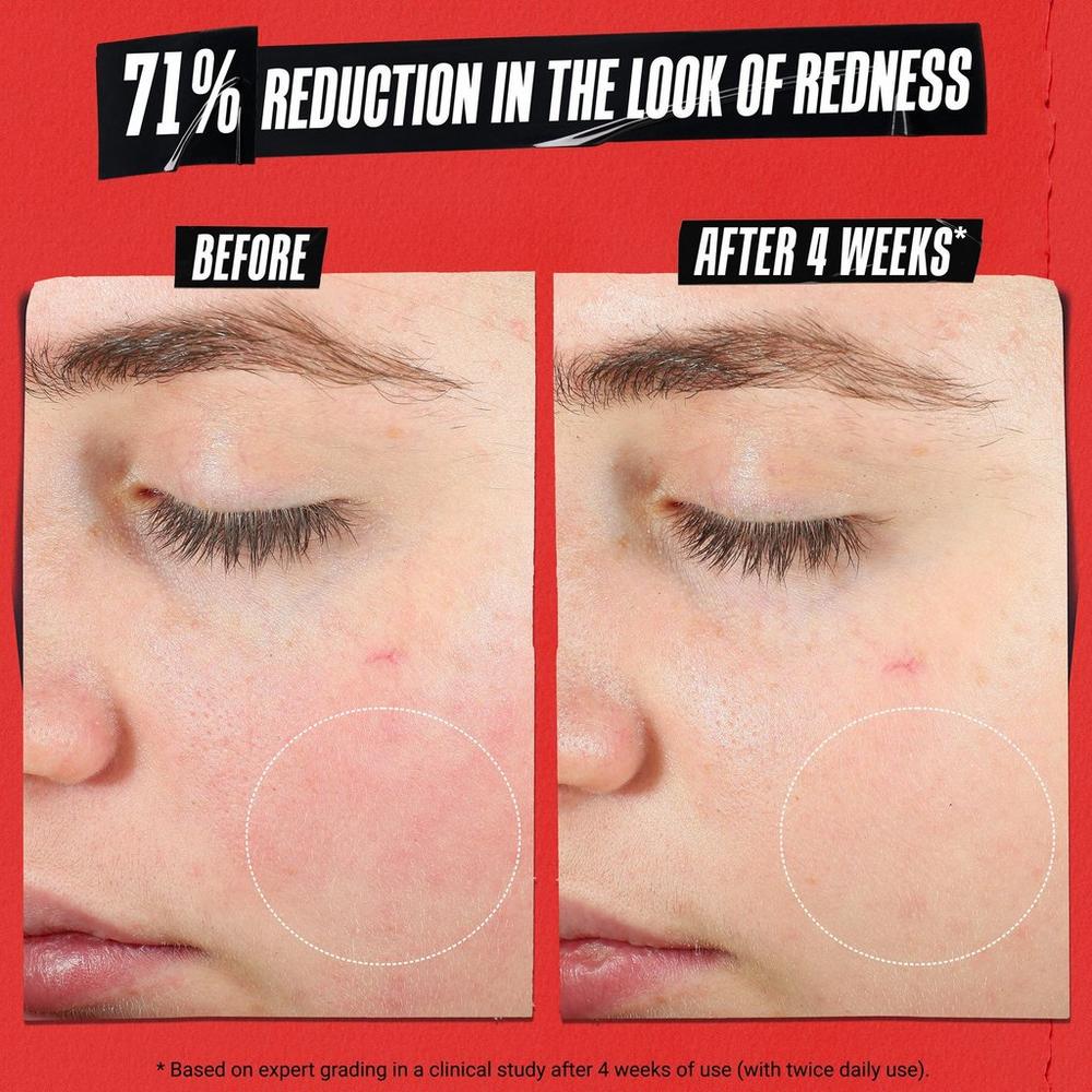 Ultra Facial Meltdown Recovery Cream Medicated - 1.6 oz