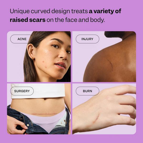 Peach Slices Scar Remedy Silicone Sheets #4