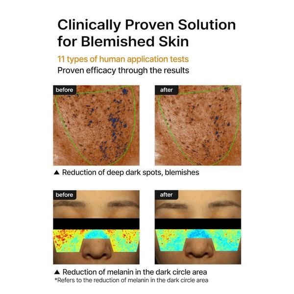 celimax Pore+Dark Spot Brightening Cream #6