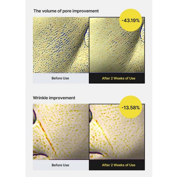 celimax The Vita-A Retinol Wrinkle Smoothing & Pore Tightening Serum #5