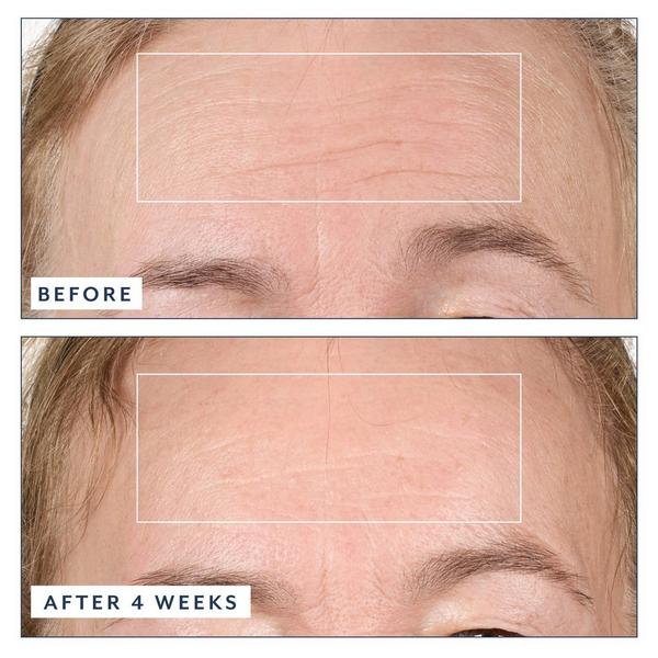 Bloomeffects Black Tulip Regenerative Serum #6