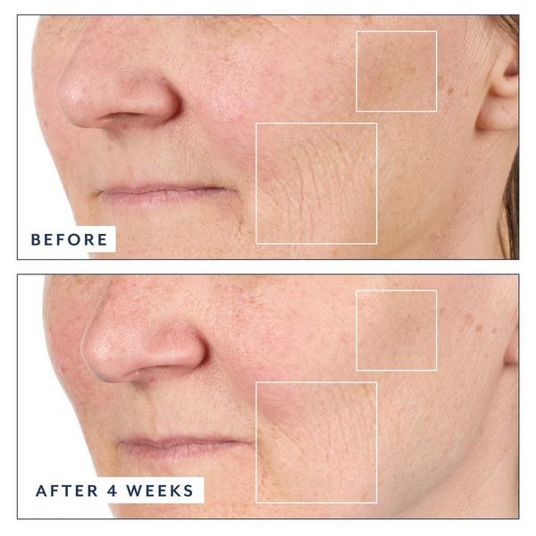 Bloomeffects Black Tulip Regenerative Serum #7