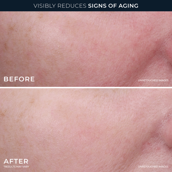 RoC Retinol Correxion Line Smoothing 2-Step Peel Pads #4