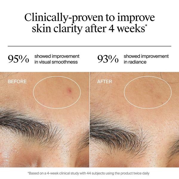 Neutrogena Evenly Clear Acne Gel Moisturizer #3