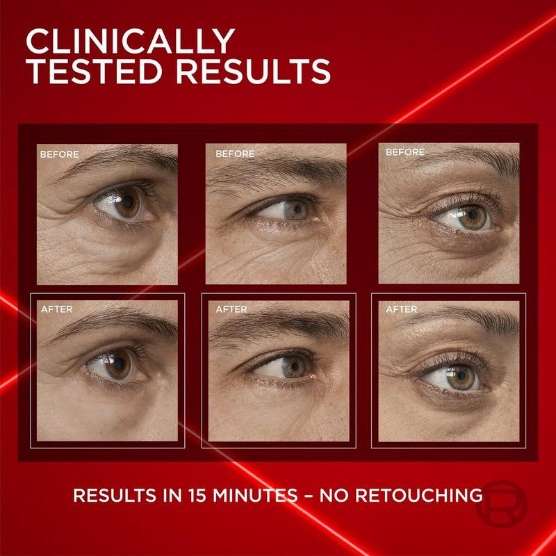 l carnitine eye bags L-carnitine: what essential information should you know?  Typology puffy and hooded eyes- L-Carnitine