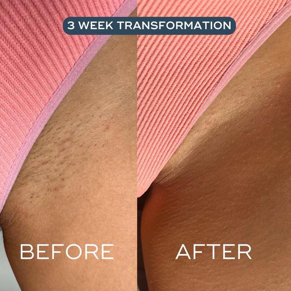 Luna Daily The Everything Oil For Ingrowns Redness & Bumps #3